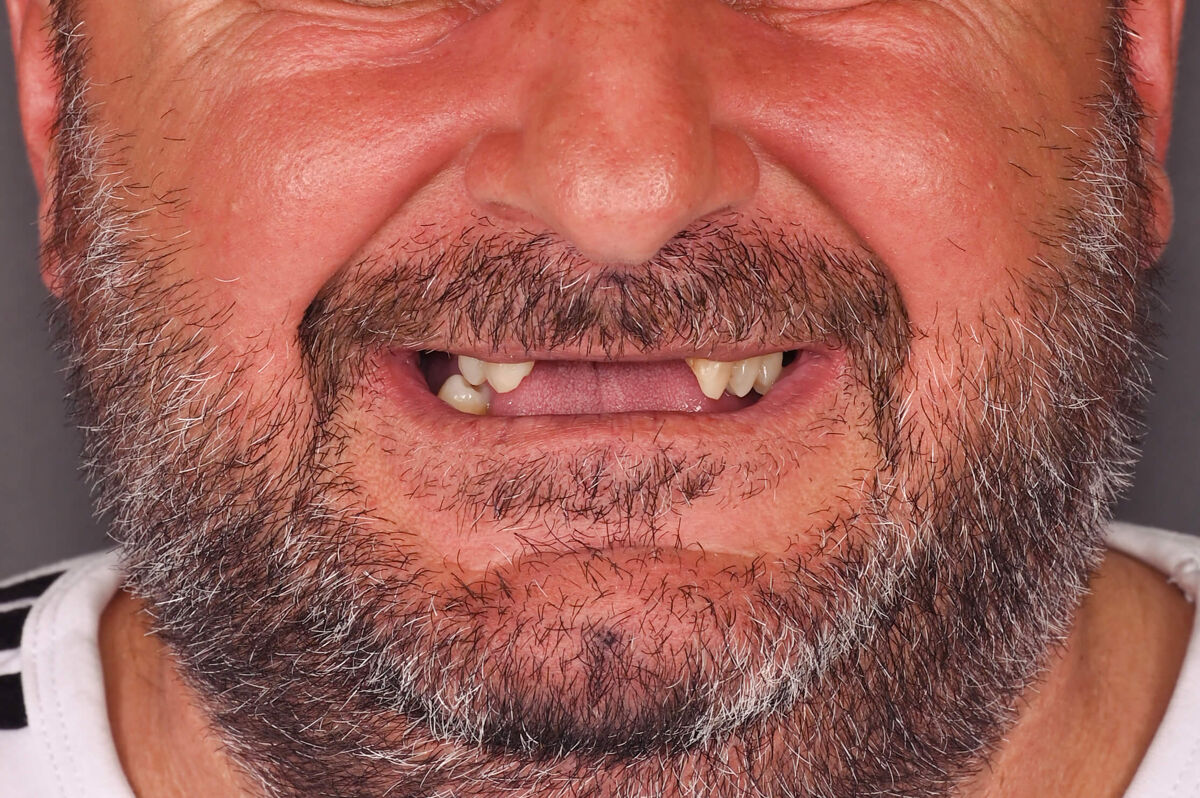 topalu nicolae - inainte